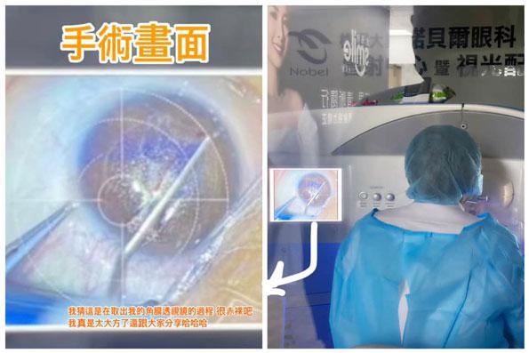 俞瑄,諾貝爾眼科,沈仁翔醫師,Smile全飛秒,近視雷射