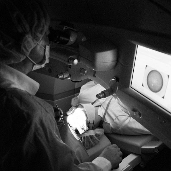 Regina,smile全飛秒,近視雷射,諾貝爾眼科,張朝凱醫師