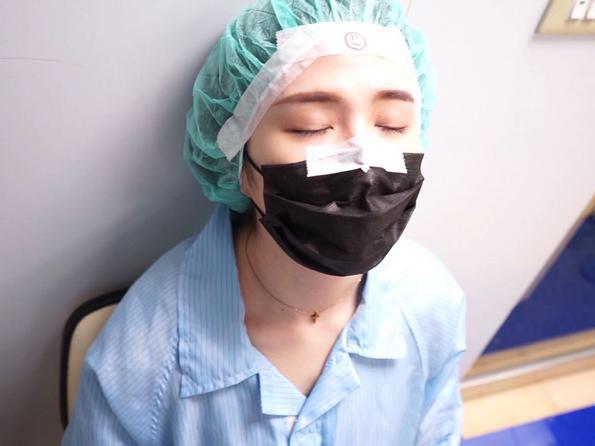 潘映竹,諾貝爾眼科,smile,全飛秒,近視雷射