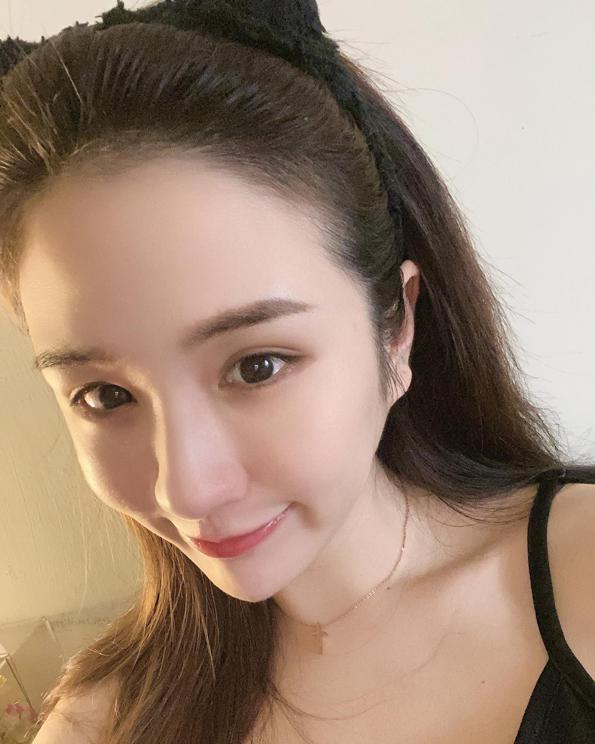 潘映竹,諾貝爾眼科,smile,全飛秒,近視雷射