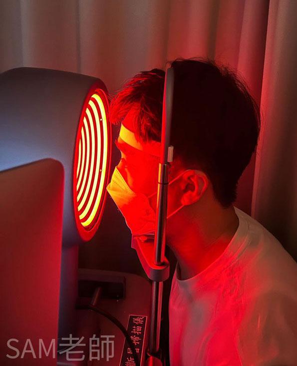 Sam老師,smile全飛秒,近視雷射,諾貝爾眼科