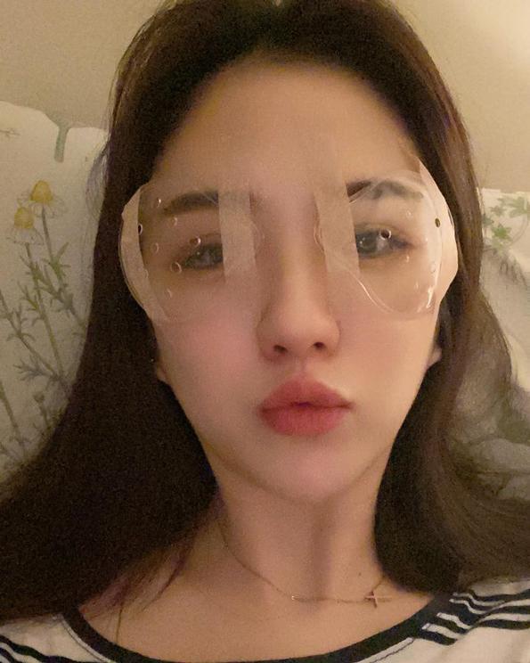 潘映竹,諾貝爾眼科,smile,全飛秒,近視雷射