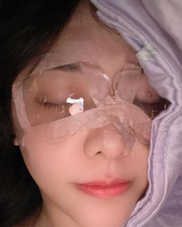 霍萱,諾貝爾眼科,近視雷射,Smile全飛秒