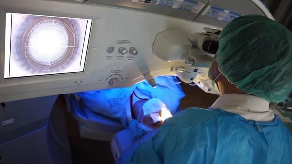 諾貝爾眼科,蔡力允,smile全飛秒,近視手術