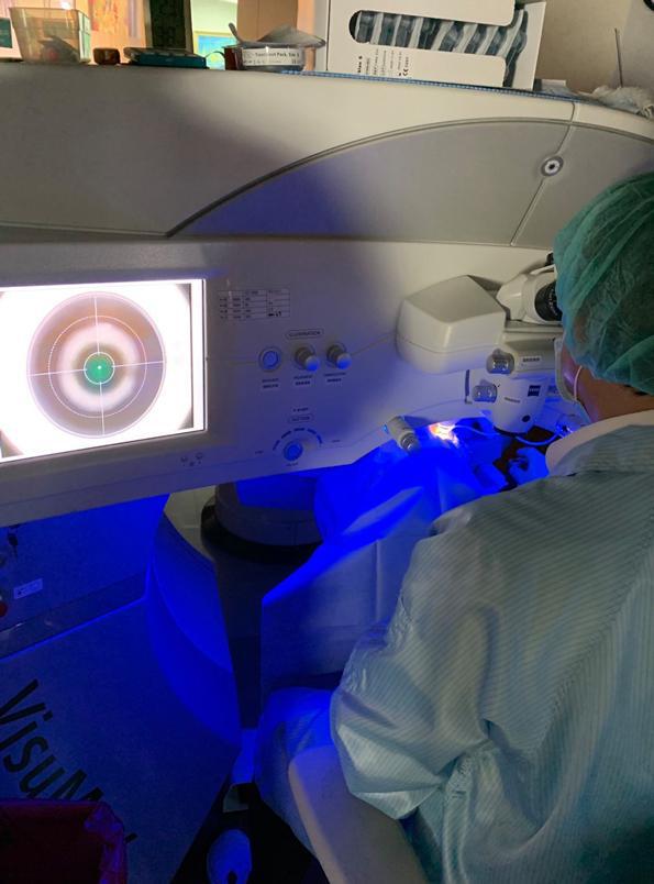 咪妃Julia,諾貝爾眼科,smile全飛秒,近視雷射