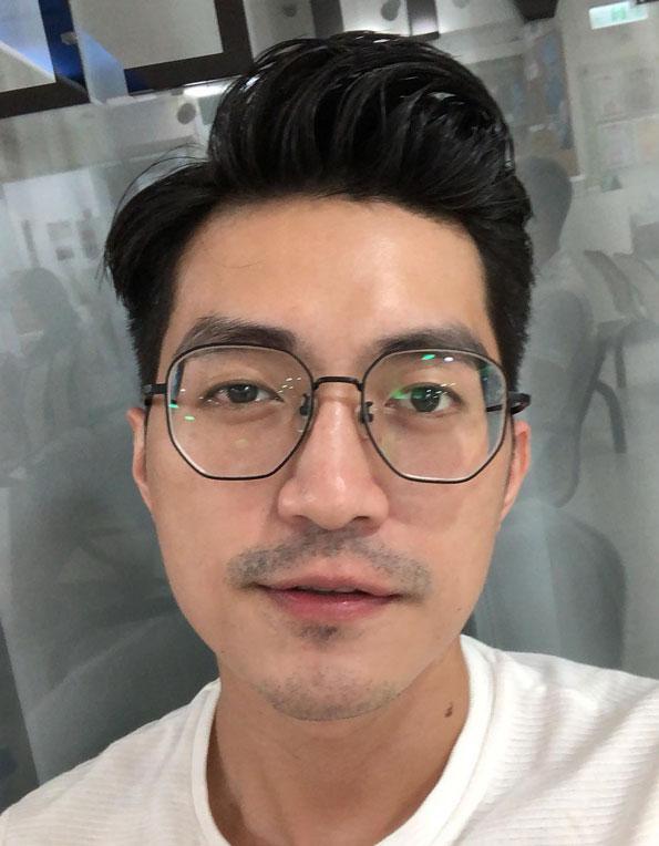 諾貝爾眼科,蔡力允,smile全飛秒,近視手術