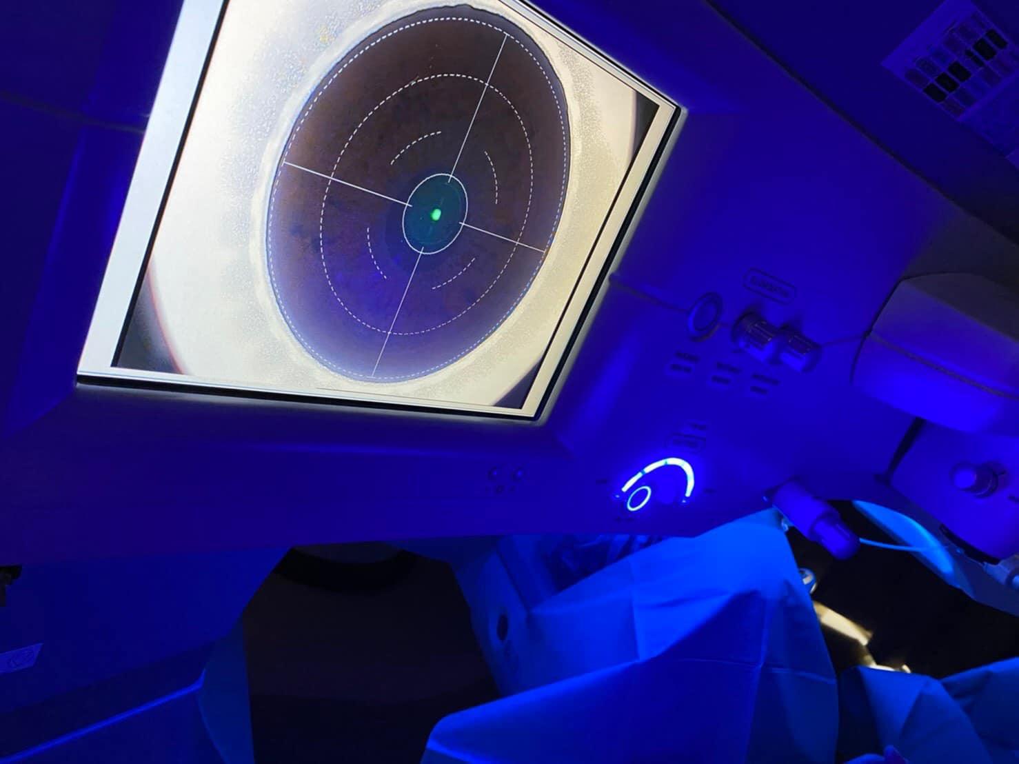 台大電機教授葉丙成,於諾貝爾眼科做SMILE全飛秒雷射手術