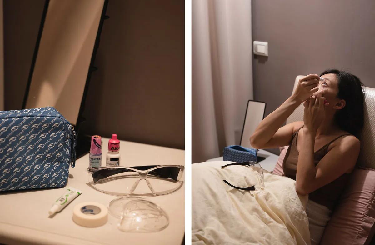 焦糖甜一點,近視雷射,smile全飛秒,諾貝爾眼科