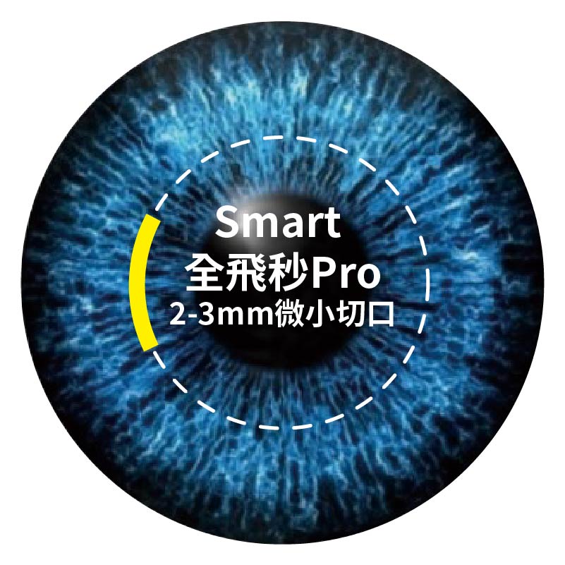 SMART Pro 全飛秒近視雷射